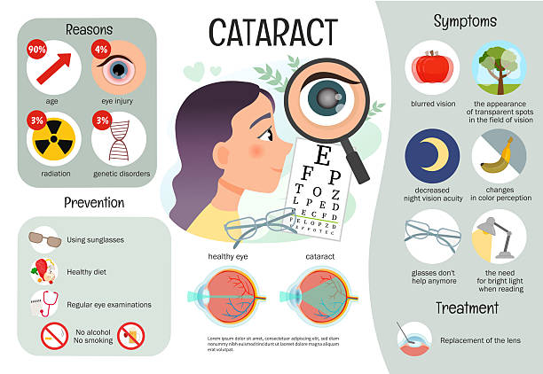 Foods to Avoid After Cataract Surgery